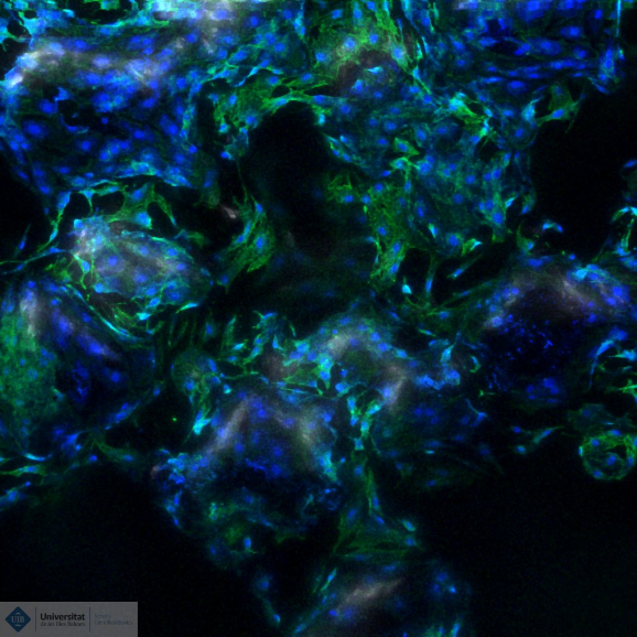 Confocal imatge 2