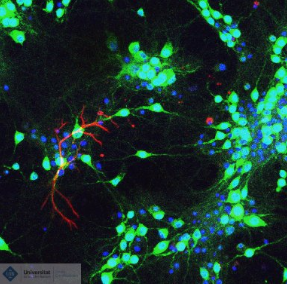 Confocal imatge 4